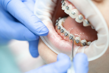 orthodontic